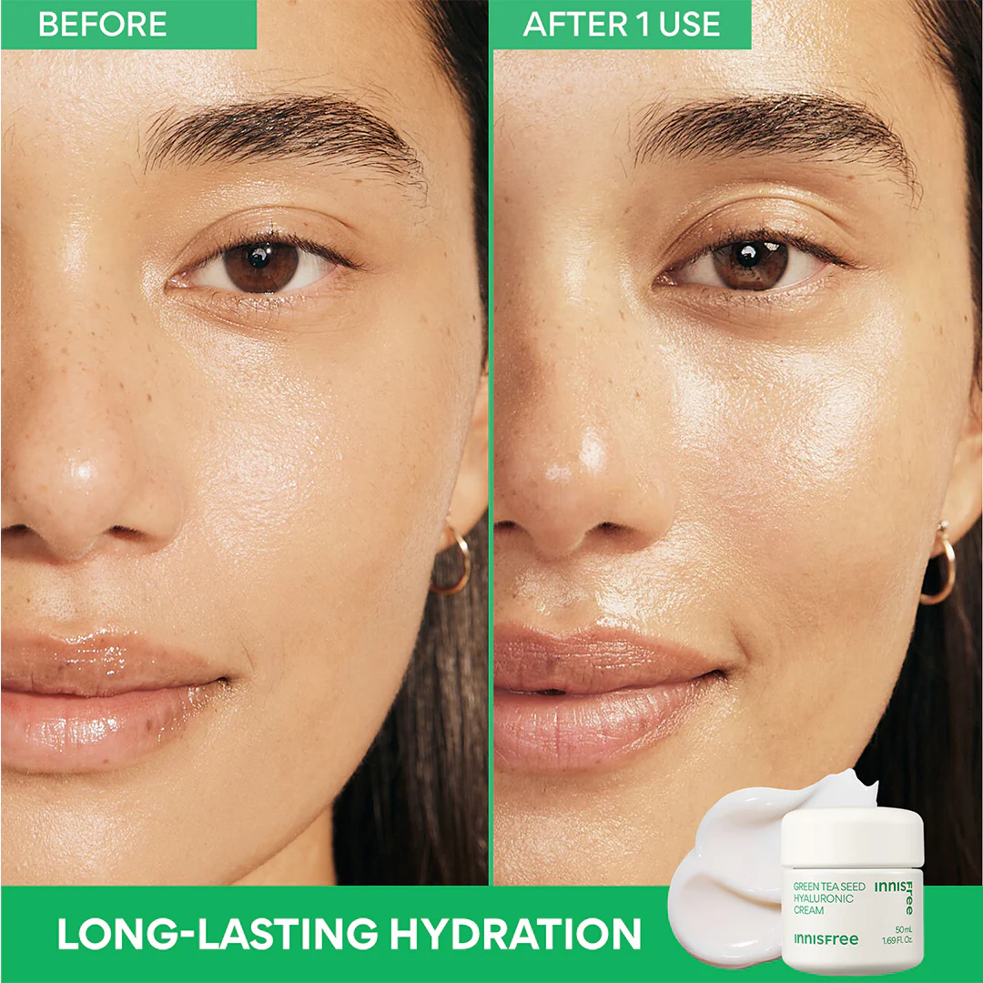 Barrier Boost Set - Image 4