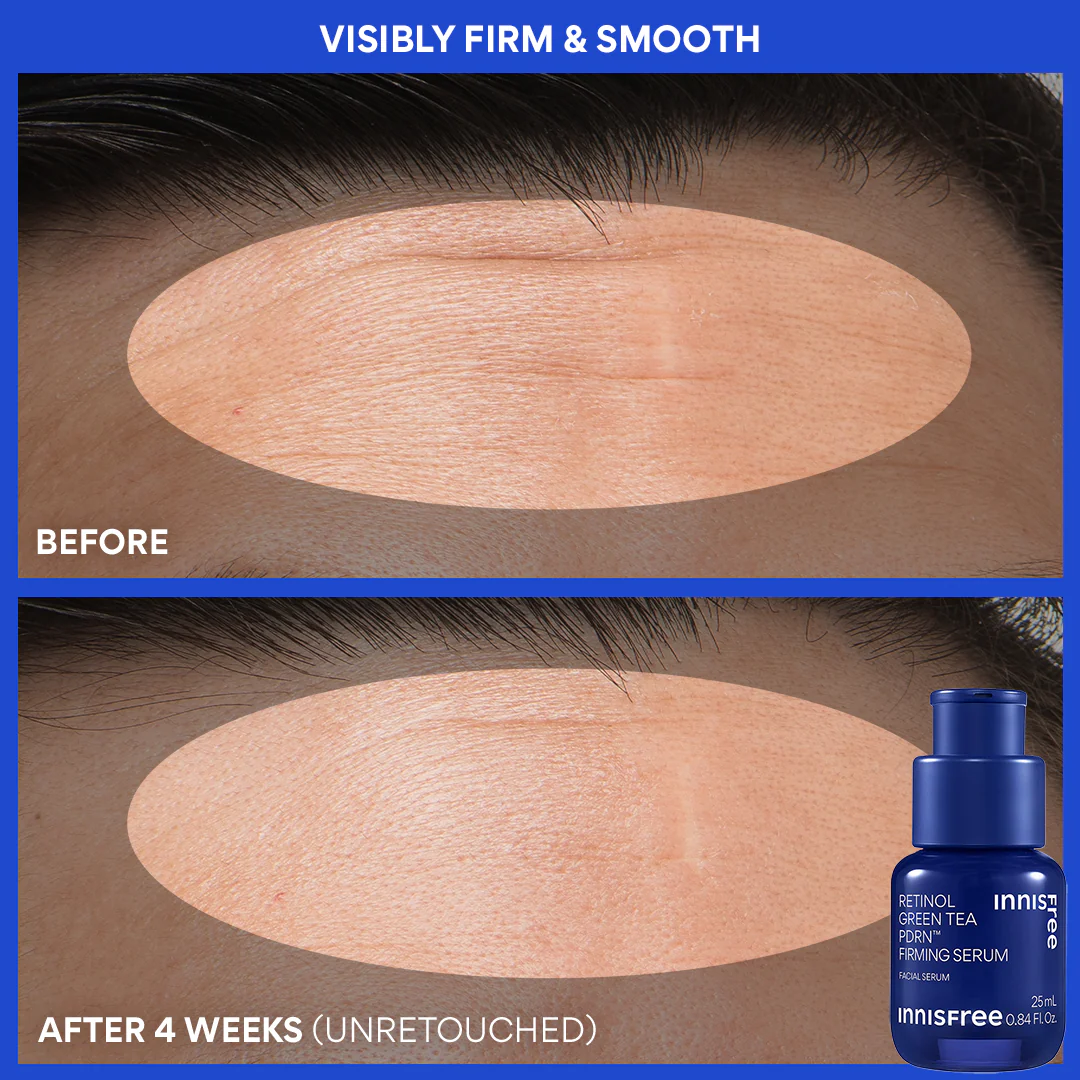 Firm + Smooth Set - Image 5