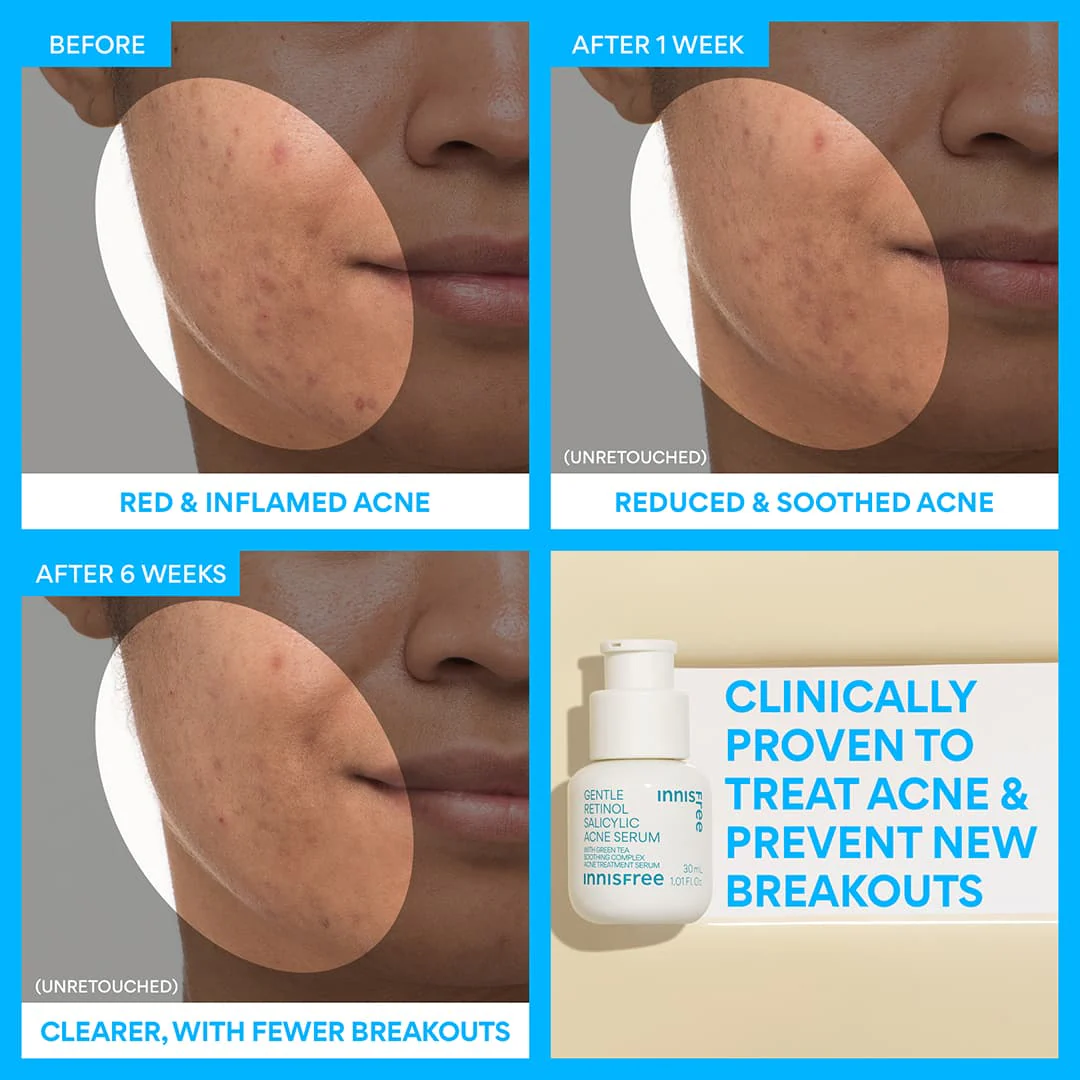 Gentle Retinol Power Duo - Image 10