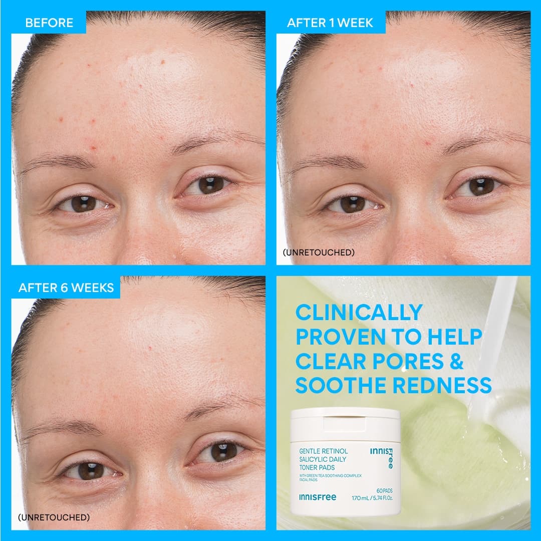 Gentle Retinol Power Duo - Image 7