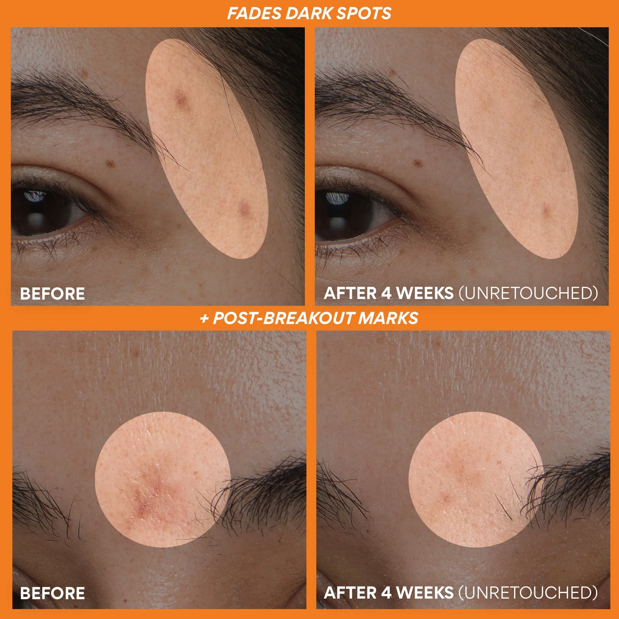 Green Tea Enzyme Vitamin C Brightening Serum – Best for Glowing Skin - Image 4