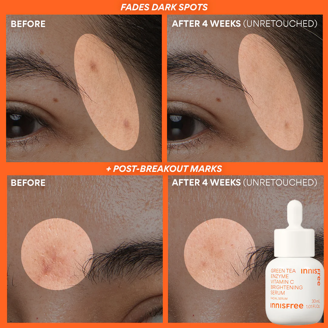 Rapid Radiance Set - Image 4