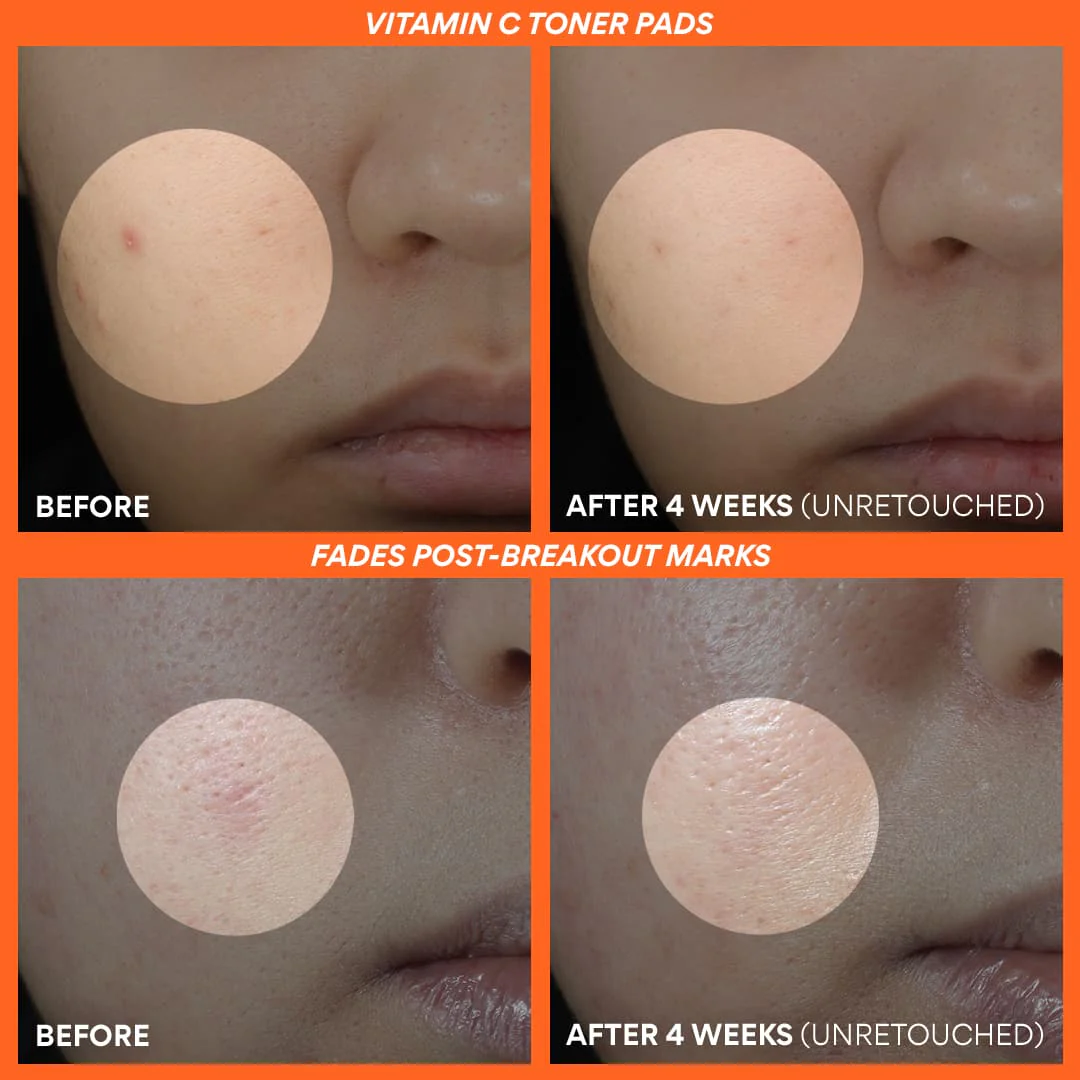 Vitamin C Brightening Power Duo - Image 3