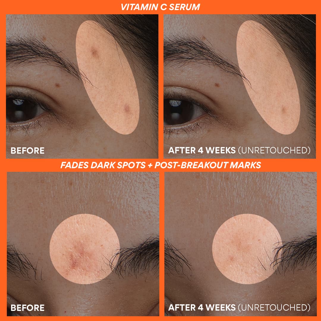 Vitamin C Brightening Power Duo - Image 4